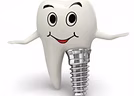 Dental Implant
